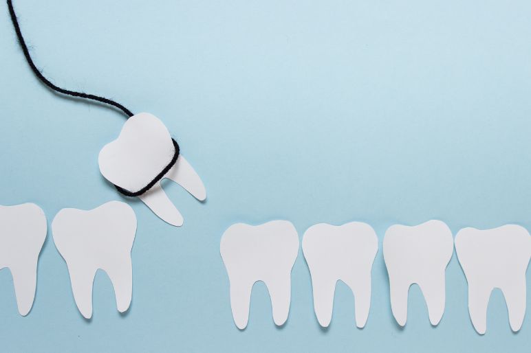 Estrazione dente del giudizio: tutto quello che devi sapere