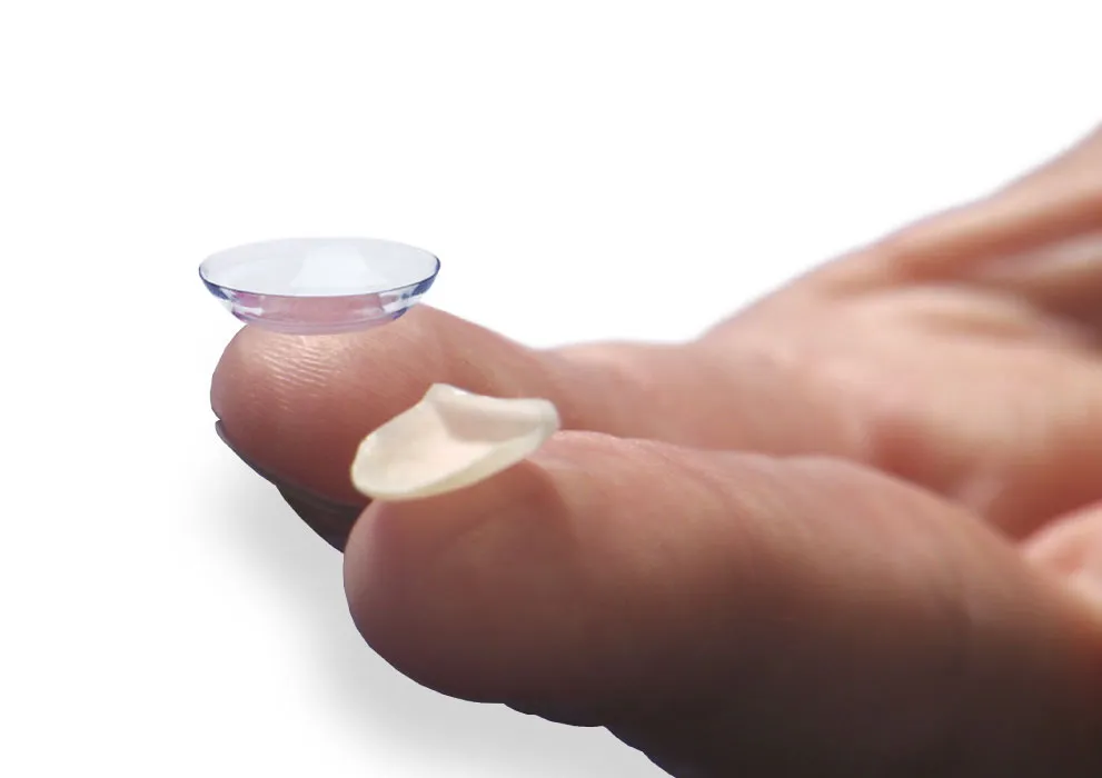 faccette dentali