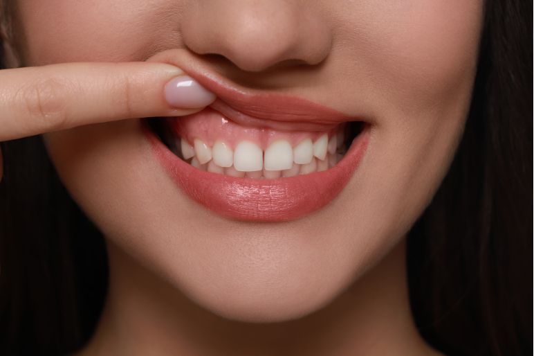 La piorrea è contagiosa? Scopri la verità!