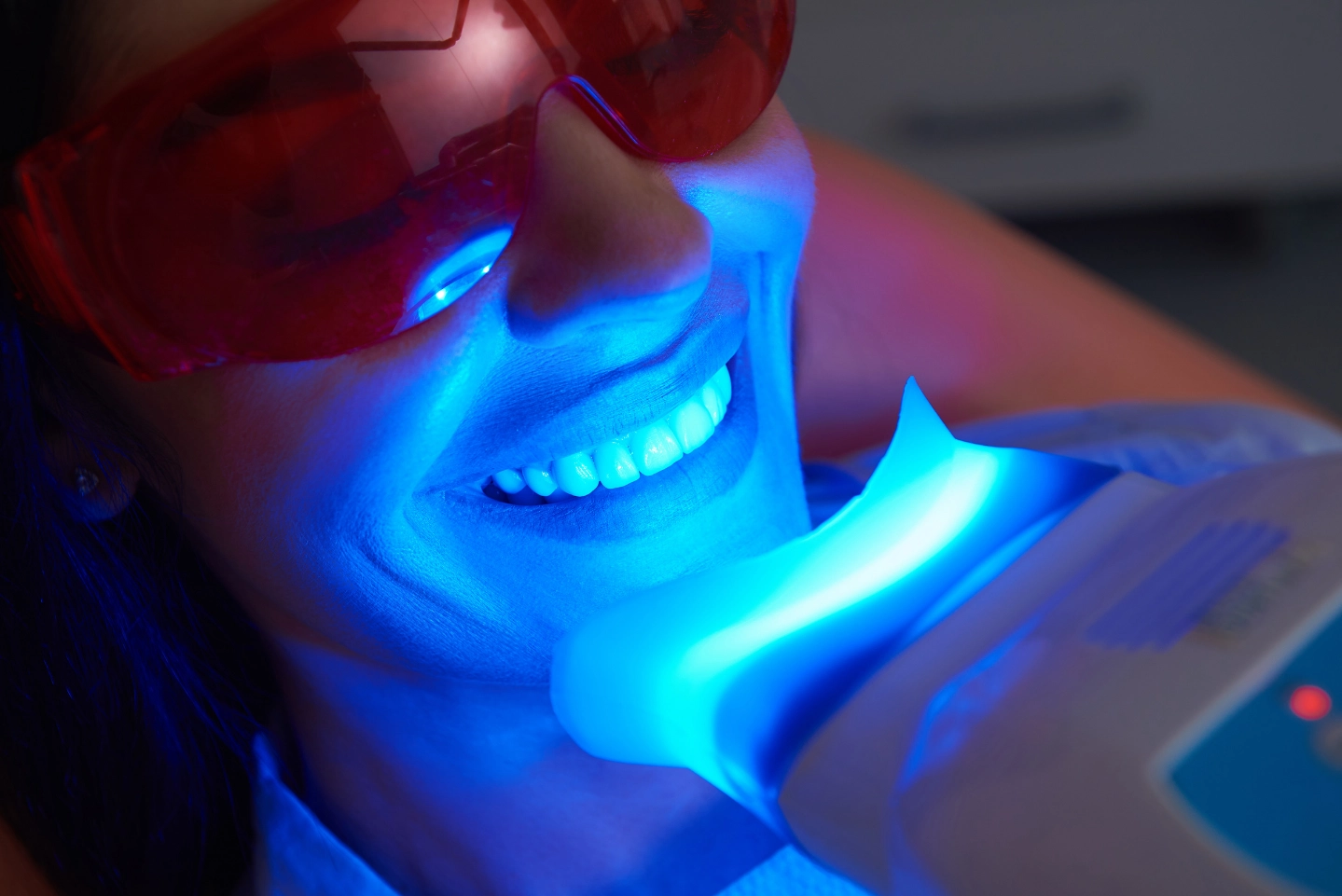 sbiancamento denti